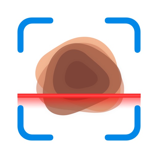 Mole Checker & Scanner: DermAi